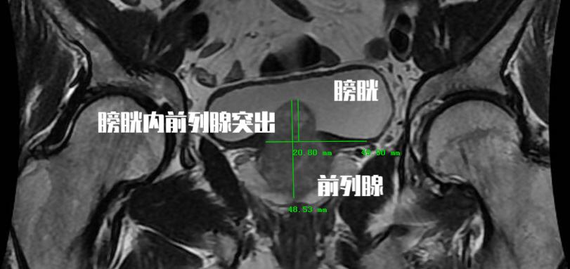 微信什么金花软件有挂（微信金花可以开挂吗）